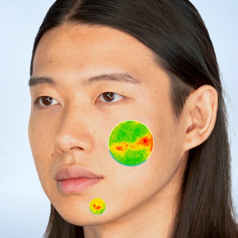 An asian man skin imperfections before/after, T0