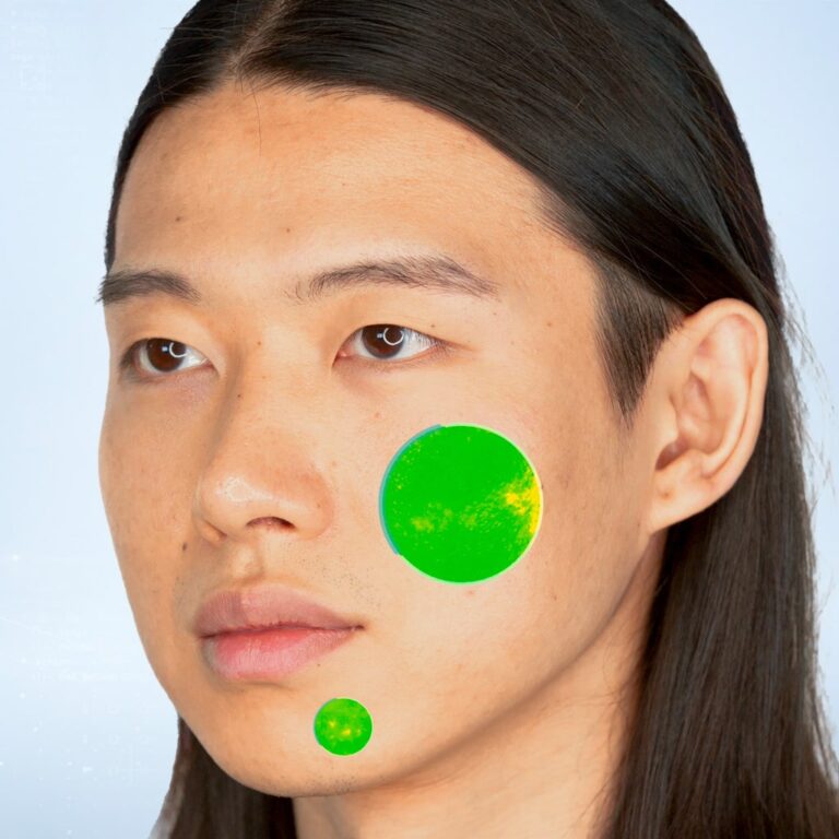 An asian man skin imperfections before/after, T2