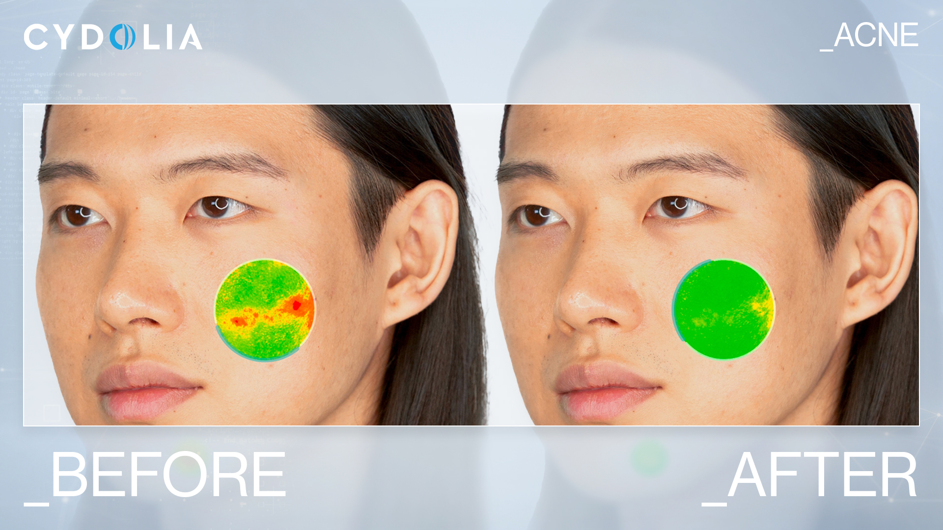 A 3D before after in cosmetic marketing