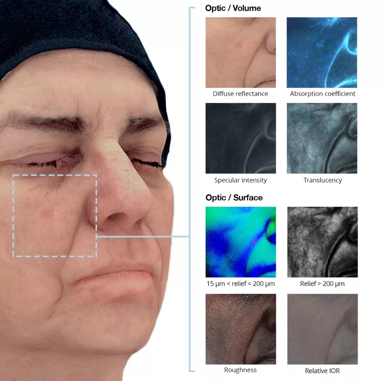 Skin properties extracted from Cydolia 3D acquisition system